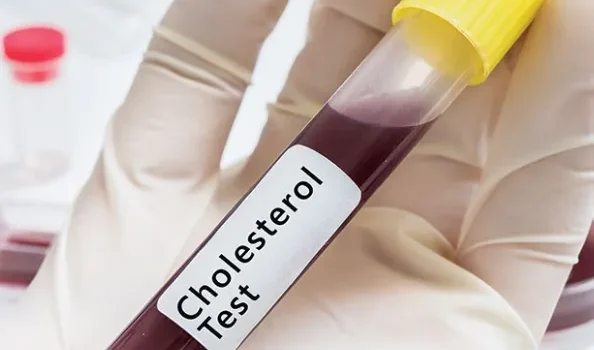 Understanding the Difference Between Cholesterol Screenings and Lipid Panels