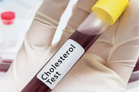 Understanding the Difference Between Cholesterol Screenings and Lipid Panels