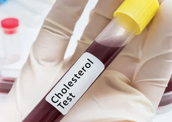 Understanding the Difference Between Cholesterol Screenings and Lipid Panels
