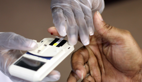 How Often Should You Get Your Cholesterol Checked?