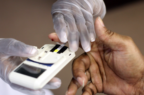 How Often Should You Get Your Cholesterol Checked?