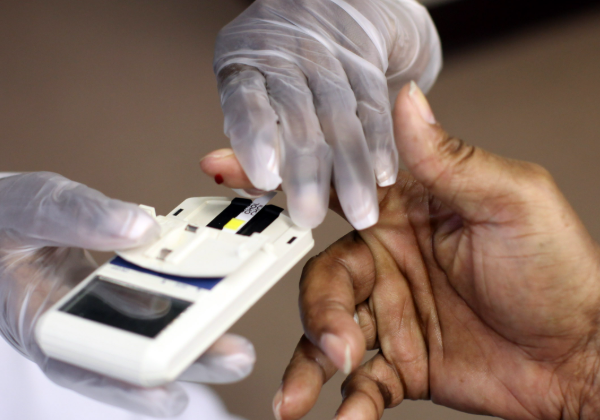 How Often Should You Get Your Cholesterol Checked?