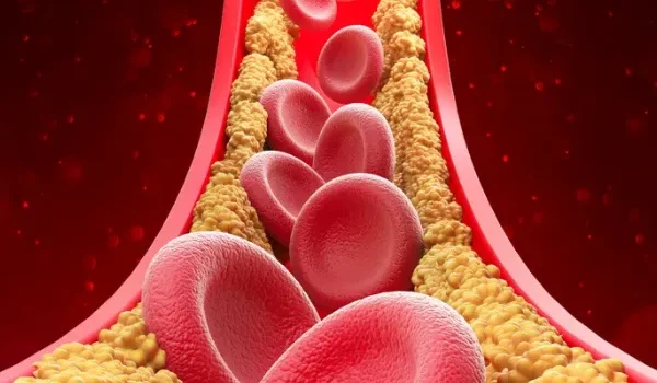 Understanding Cholesterol Fluctuations: What Causes Them and How to Manage Them