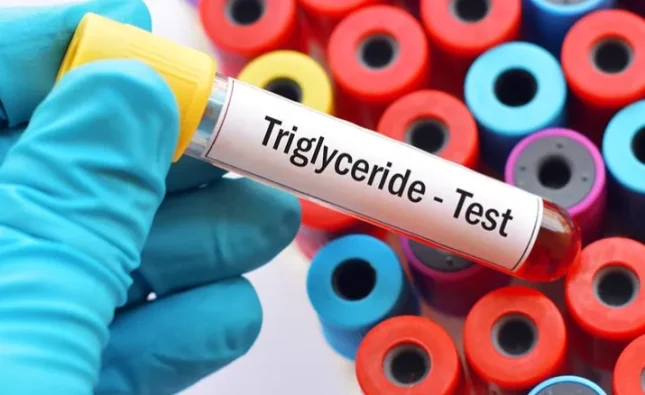 Understanding LDL, HDL, and Triglycerides in Cholesterol Testing