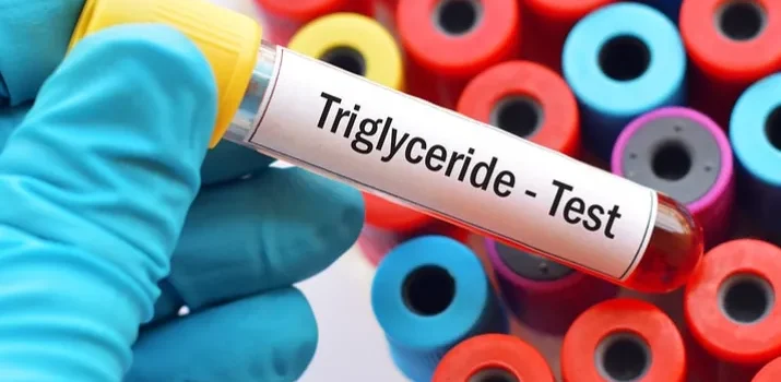 Understanding LDL, HDL, and Triglycerides in Cholesterol Testing