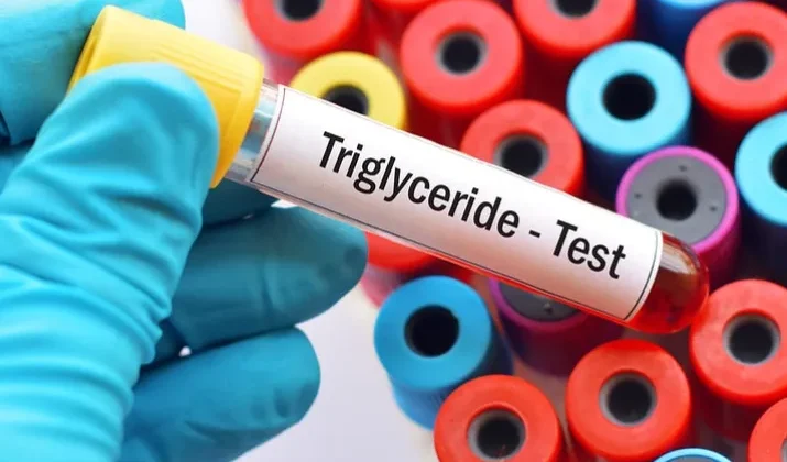 Understanding LDL, HDL, and Triglycerides in Cholesterol Testing