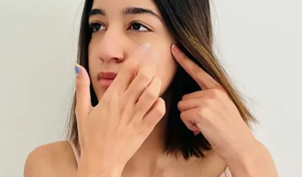 Achieving Clear Skin with Hydrocolloid Pimple Patches