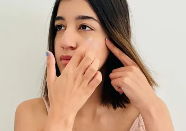Achieving Clear Skin with Hydrocolloid Pimple Patches