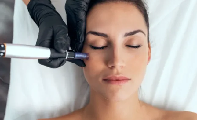 Microneedling for Acne Scars: Your Path to Smooth and Clear Skin